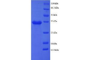 Pro-Platelet Basic Protein (Chemokine (C-X-C Motif) Ligand 7) (PPBP) (AA 59-125), (partial) protein (GST tag)
