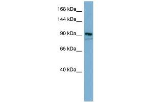 WB Suggested Anti-FAM62B Antibody Titration:  0. (FAM62B 抗体  (Middle Region))
