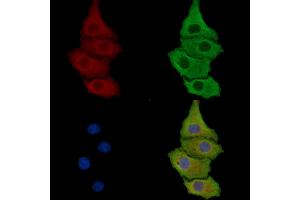ABIN7095808 and ABIN7099870 staining HepG2 cells by IF/ICC. (SEL1L 抗体)
