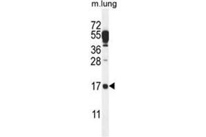 Western Blotting (WB) image for anti-Chromosome 14 Open Reading Frame 126 (C14orf126) (AA 143-172), (C-Term) antibody (ABIN950751)