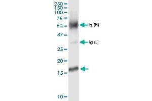 Immunoprecipitation of MTP18 transfected lysate using anti-MTP18 MaxPab rabbit polyclonal antibody and Protein A Magnetic Bead , and immunoblotted with MTP18 MaxPab rabbit polyclonal antibody (D01) . (Mtfp1 抗体  (AA 1-166))