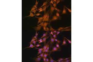 Immunofluorescence (IF) image for anti-ELOVL Fatty Acid Elongase 4 (ELOVL4) (AA 1-100) antibody (ABIN1679709)