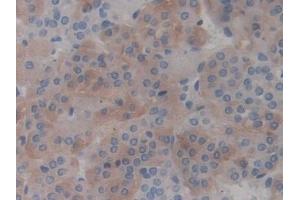 Immunohistochemistry (IHC) image for anti-Advanced Glycosylation End Product-Specific Receptor (AGER) (AA 180-402) antibody (ABIN7443794)