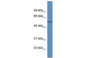 WB Suggested Anti-ARHGAP19 AntibodyTitration: 1. (ARHGAP19 抗体  (C-Term))