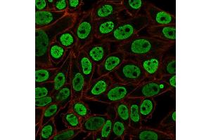 Immunofluorescent staining of paraformaldehyde-fixed HeLa cells with Pan-Nuclear Antigen Monoclonal Antibody (NM106) followed by goat anti-Mouse IgG-CF488 (Green). (Nuclear Antigen (Pan-Nuclear Marker) 抗体)