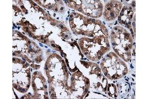 Immunohistochemical staining of paraffin-embedded Kidney tissue using anti-SATB1mouse monoclonal antibody. (SATB1 抗体)