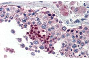 Immunohistochemistry with Human Testis lysate tissue at an antibody concentration of 5. (NR0B1 抗体  (Middle Region))