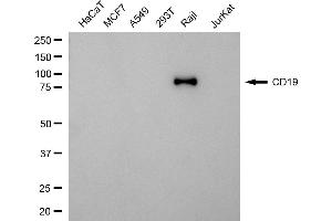 Western blotting analysis using CD19 antibody (ABIN7797955).