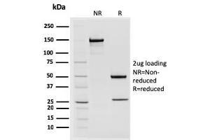 SDS-PAGE Analysis Purified STAT2 Mouse Monoclonal Antibody (STAT2/2650). (STAT2 抗体)