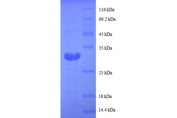 MT1G Protein (AA 1-59, partial) (GST tag)