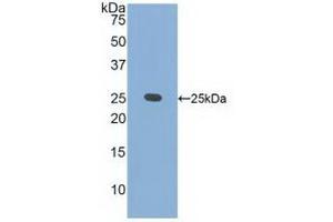 Western blot analysis of recombinant Human CRADD. (CRADD 抗体  (AA 1-199))