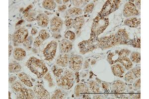 Immunoperoxidase of monoclonal antibody to TPP1 on formalin-fixed paraffin-embedded human salivary gland. (TPP1 抗体  (AA 195-304))
