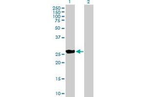 Western Blot analysis of BNIP1 expression in transfected 293T cell line by BNIP1 MaxPab polyclonal antibody. (BNIP1 抗体  (AA 1-228))