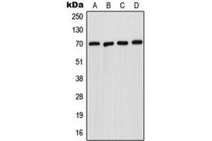 Western blot analysis of Acid Sphingomyelinase expression in A431 (A), HepG2 (B), SP2/0 (C), H9C2 (D) whole cell lysates. (SMPD1 抗体  (Center))