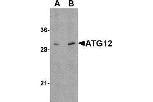 Western blot: ATG12 antibody staining of Human brain tissue lysate at (A) 0. (ATG12 抗体  (N-Term))