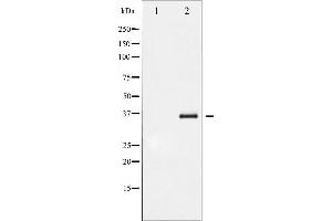 Western blot analysis of I kappaB- beta phosphorylation expression in TNF-a treated HeLa whole cell lysates,The lane on the left is treated with the antigen-specific peptide.