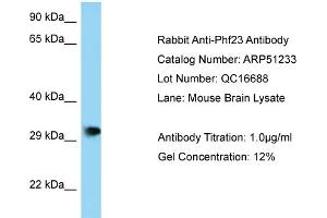 WB Suggested Anti-Phf23 Antibody   Titration: 1. (PHF23 抗体  (N-Term))