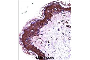 S100A7 Antibody (N-term) ((ABIN657716 and ABIN2846704))immunohistochemistry analysis in formalin fixed and paraffin embedded human skin tissue followed by peroxidase conjugation of the secondary antibody and DAB staining. (S100A7 抗体  (N-Term))