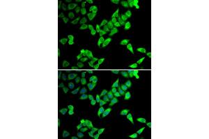 Immunofluorescence analysis of U20S cell using TRIP10 antibody. (TRIP10 抗体)