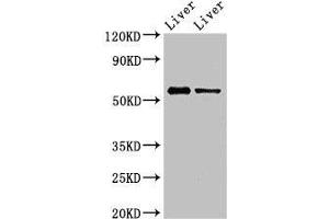 Western Blot Positive WB detected in: Mouse liver tissue, Rat liver tissue All lanes: ETV1 antibody at 3 μg/mL Secondary Goat polyclonal to rabbit IgG at 1/50000 dilution Predicted band size: 56, 54, 53, 44, 49, 51 kDa Observed band size: 56 kDa