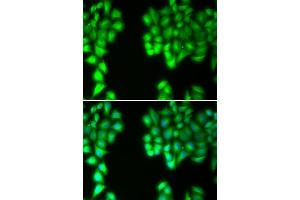 Immunofluorescence analysis of U20S cell using MALT1 antibody. (MALT1 抗体  (AA 125-450))