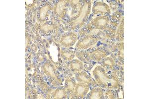 Immunohistochemistry of paraffin-embedded rat kidney using MBP antibody (ABIN5970825) at dilution of 1/200 (40x lens). (MBP 抗体)