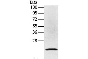 Western Blot analysis of Jurkat cell using TP53I11 Polyclonal Antibody at dilution of 1:400 (TP53I11 抗体)