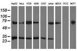 Image no. 1 for anti-Pyrroline-5-Carboxylate Reductase Family, Member 2 (PYCR2) antibody (ABIN1499983) (PYCR2 抗体)