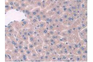 IHC-P analysis of Mouse Liver Tissue, with DAB staining. (TPP1 抗体  (AA 198-562))