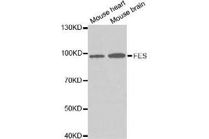 Western blot analysis of extracts of various cell lines, using FES antibody. (FES 抗体  (AA 120-420))