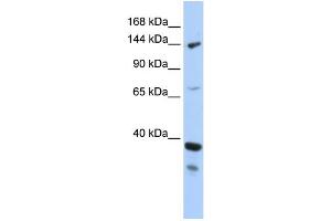 WB Suggested Anti-DHX37 Antibody Titration:  0. (DHX37 抗体  (N-Term))