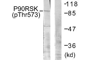 Western blot analysis of extracts from 293 cells, treated with UV (30 mins), using p90 RSK (Phospho-Thr573) antibody. (RPS6KA3 抗体  (pThr573))