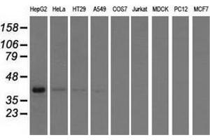 Western blot analysis of extracts (35 µg) from 9 different cell lines by using anti-HIBCH monoclonal antibody. (HIBCH 抗体)