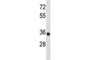 ISL1 antibody western blot analysis in mouse bladder tissue lysate. (ISL1 抗体  (AA 156-185))
