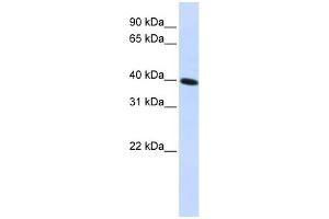 WB Suggested Anti-CARKD Antibody Titration:  0.