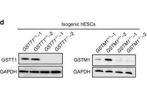 Western Blotting (WB) image for anti-Glutathione S-Transferase theta 1 (GSTT1) antibody (ABIN2856663)