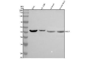 Western blot analysis of Beta Sarcoglycan/SGCB using anti-Beta Sarcoglycan/SGCB antibody (ABIN7825786).
