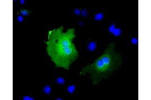 Anti-KBTBD7 mouse monoclonal antibody (ABIN2453189) immunofluorescent staining of COS7 cells transiently transfected by pCMV6-ENTRY KBTBD7 (RC205559). (KBTBD7 抗体)