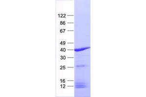 Western Blotting (WB) image for Cyclin-Dependent Kinase 20 (CDK20) protein (His tag) (ABIN2713330)