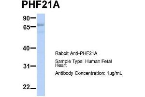Host:  Rabbit  Target Name:  PHF21A  Sample Type:  Human Fetal Heart  Antibody Dilution:  1. (PHF21A 抗体  (N-Term))