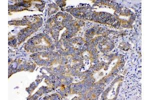 IHC analysis of SCF using anti-SCF antibody . (KIT Ligand 抗体  (AA 26-190))