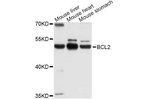 Western blot analysis of extracts of various cell lines, using POU2F3 Antibody (ABIN4904821) at 1:1000 dilution. (POU2F3 抗体)