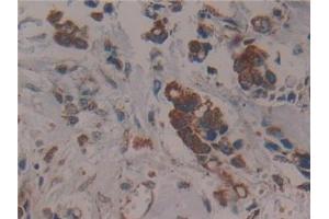 Immunohistochemistry (IHC) image for anti-Citrate Synthase (CS) (AA 103-394) antibody (ABIN7440647)