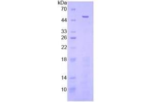 SDS-PAGE analysis of Human FGL2 Protein. (FGL2 蛋白)