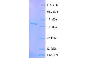 SDS-PAGE (SDS) image for Calcium Activated Nucleotidase 1 (CANT1) (AA 80-397), (partial) protein (His tag) (ABIN5712840) (CANT1 Protein (AA 80-397, partial) (His tag))