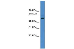 WB Suggested Anti-ZNF277 Antibody Titration:  0. (ZNF277 抗体  (N-Term))