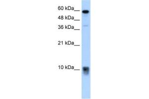 Western Blotting (WB) image for anti-S100 Calcium Binding Protein A3 (S100A3) antibody (ABIN2462524) (S100A3 抗体)