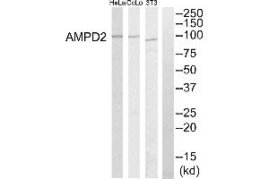 Western blot analysis of extracts from HeLa cells, NIH-3T3 cells and COLO205 cells, using AMPD2 antibody. (AMPD2 抗体)