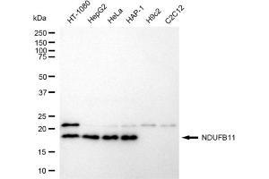 Western blotting analysis using NDUFB11 antibody (ABIN7799549).