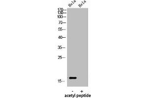Western Blot analysis of hela using Acetyl-Histone H3 (K9) Polyclonal Antibody. (HIST1H3A/HIST2H3A/H3F3A (acLys9) 抗体)